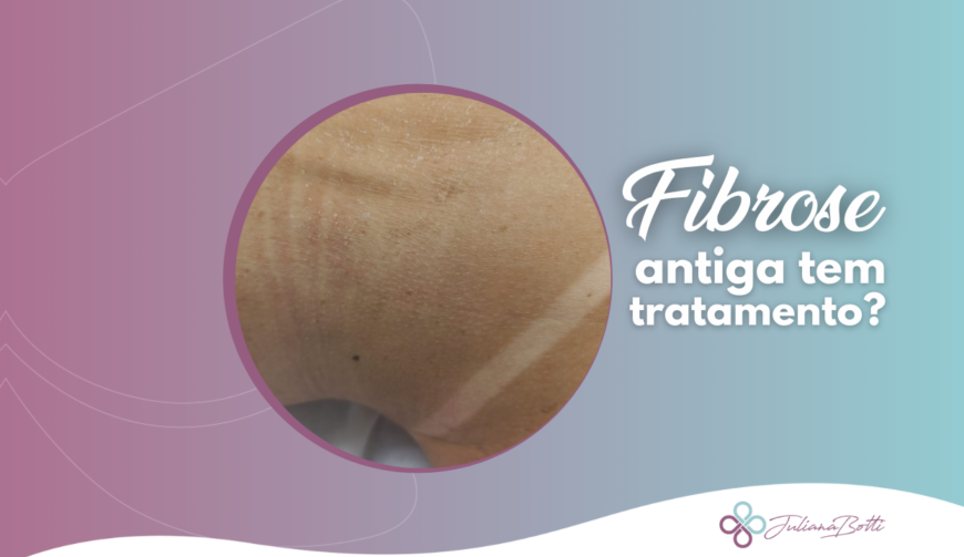 Fibrose Tem Tratamento - Juliana Botti